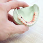 Top Tooth Replacement Options